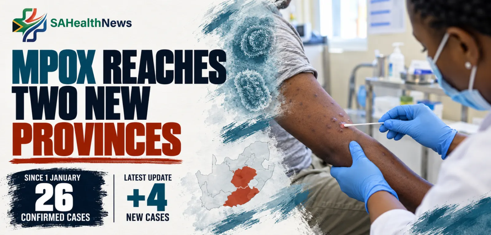 Mpox reaches the Eastern Cape and Free State as national count rises to 26